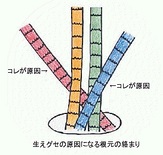 髪の絡まりとは？ご存じですか？